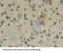 Connective Tissue Growth Factor (CCN2) Antibody