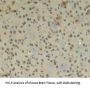 Connective Tissue Growth Factor (CCN2) Antibody