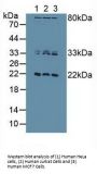 Dual Specificity Phosphatase 3 (DUSP3) Antibody
