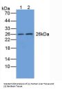 Glutathione S Transferase Mu 1 (GSTm1) Antibody