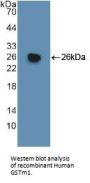 Glutathione S Transferase Mu 1 (GSTm1) Antibody