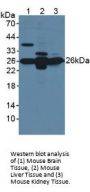 Glutathione S Transferase Mu 1 (GSTm1) Antibody