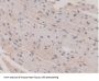 Glutathione S Transferase Mu 1 (GSTm1) Antibody