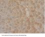 Glutathione S Transferase Mu 1 (GSTm1) Antibody