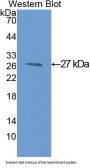 Glutathione S Transferase Mu 1 (GSTm1) Antibody