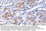 Growth Differentiation Factor 1 (GDF1) Antibody