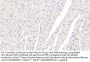 Growth Differentiation Factor 1 (GDF1) Antibody