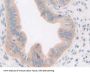 Growth Differentiation Factor 5 (GDF5) Antibody