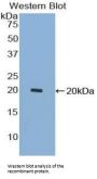 Growth Differentiation Factor 7 (GDF7) Antibody