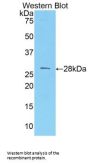 Melanoma Cell Adhesion Molecule (MCAM) Antibody