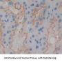 Melanoma Cell Adhesion Molecule (MCAM) Antibody