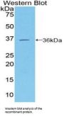 Melanoma Cell Adhesion Molecule (MCAM) Antibody