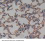 Melanoma Cell Adhesion Molecule (MCAM) Antibody