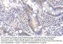 Tissue Factor Pathway Inhibitor (TFPI) Antibody