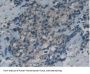 Growth Arrest Specific Protein 6 (GAS6) Antibody