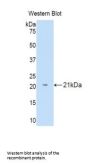 IL18BP Antibody