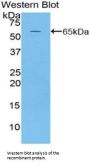 Microtubule Associated Protein 2 (MAP2) Antibody