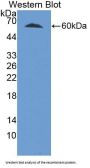 Telomerase Reverse Transcriptase (TERT) Antibody