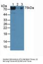 Telomerase Reverse Transcriptase (TERT) Antibody