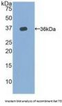 Telomerase Reverse Transcriptase (TERT) Antibody