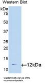 Transforming Growth Factor Alpha (TGFA) Antibody