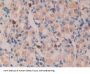 Transforming Growth Factor Alpha (TGFA) Antibody
