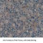 Transforming Growth Factor Alpha (TGFA) Antibody