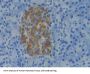 APRT Antibody