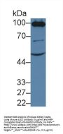 Angiotensin I Converting Enzyme 2 (ACE2) Antibody