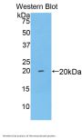 Brain-Derived Neurotrophic Factor (BDNF) Antibody