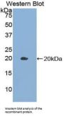 Growth Differentiation Factor 10 (GDF10) Antibody