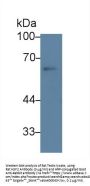 Heat Shock Transcription Factor 2 (HSF2) Antibody