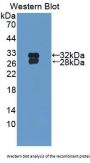 Heat Shock Transcription Factor 2 (HSF2) Antibody