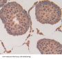 Heat Shock Transcription Factor 2 (HSF2) Antibody