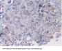 Hypoxia Inducible Factor 1 Alpha (HIF1a) Antibody