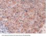 Hypoxia Inducible Factor 1 Alpha (HIF1a) Antibody