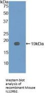 Interleukin 12 Receptor Beta 2 (IL12Rb2) Antibody