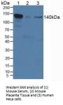 Interleukin 12 Receptor Beta 2 (IL12Rb2) Antibody