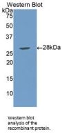 Lipopolysaccharide Binding Protein (LBP) Antibody