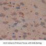 Lipopolysaccharide Binding Protein (LBP) Antibody
