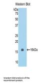 Protein O-GlcNAcase / MGEA5 (OGA) Antibody