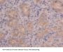 Polymeric Immunoglobulin Receptor (PIGR) Antibody