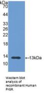 Polymeric Immunoglobulin Receptor (PIGR) Antibody