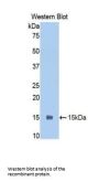 Polymeric Immunoglobulin Receptor (PIGR) Antibody