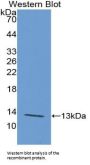 Polymeric Immunoglobulin Receptor (PIGR) Antibody