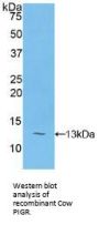Polymeric Immunoglobulin Receptor (PIGR) Antibody