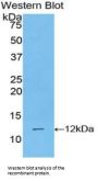 Polymeric Immunoglobulin Receptor (PIGR) Antibody
