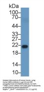 Retinol Binding Protein 4, Plasma (RBP4) Antibody