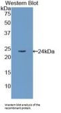Retinol Binding Protein 4, Plasma (RBP4) Antibody