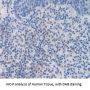 S100 Calcium Binding Protein A7 (S100A7) Antibody